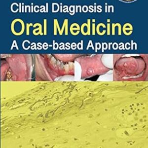 خرید و دانلود نسخه کامل کتاب Clinical Diagnosis in Oral Medicine: A Case-based Approach