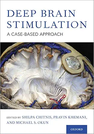 خرید و دانلود نسخه کامل کتاب Deep Brain Stimulation: A Case-based Approach_6a6cce1665f07.webp خرید و دانلود نسخه کامل کتاب Deep Brain Stimulation: A Case-based Approach