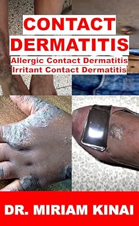 خرید و دانلود نسخه کامل کتاب Contact Dermatitis (Dermatology)_6a69828f7d2f7.jpeg خرید و دانلود نسخه کامل کتاب Contact Dermatitis (Dermatology)