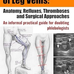 خرید و دانلود نسخه کامل کتاب Duplex Ultrasound of Leg Veins: Anatomy, Refluxes, Thromboses, and Surgical Approaches: An Informal Practical Guide for Doubting Phlebologists