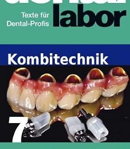خرید و دانلود نسخه کامل کتاب Restauration mit Implantaten und Teleskop-Prothesen (das dental labor Fachtexte 47) (German Edition)