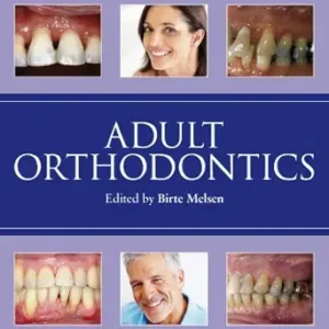 خرید و دانلود نسخه کامل کتاب Adult Orthodontics