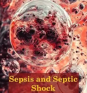 خرید و دانلود نسخه کامل کتاب Sepsis and Septic Shock: Navigating Sepsis and Septic Shock: A Critical Review of the Sepsis-3 Definitions, Clinical Criteria, and Implications for Patient Management