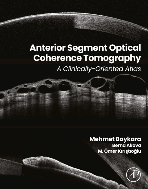 خرید و دانلود نسخه کامل کتاب
Anterior Segment Optical Coherence Tomography: A Clinically-Oriented Atlas_6a5e856e519cf.webp خرید و دانلود نسخه کامل کتاب
Anterior Segment Optical Coherence Tomography: A Clinically-Oriented Atlas - تصویر 1