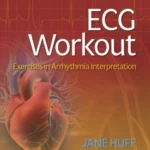 خرید و دانلود نسخه کامل کتاب 
ECG Workout: Exercises in Arrhythmia Interpretation 8th Edition, Eighth, North American Edition