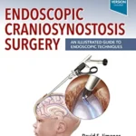 خرید و دانلود نسخه کامل کتاب 
Endoscopic Craniosynostosis Surgery: An Illustrated Guide to Endoscopic Techniques