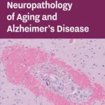 خرید و دانلود نسخه کامل کتاب 
Neuropathology of Aging and Alzheimer's Disease