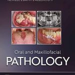 خرید و دانلود نسخه کامل کتاب Oral and Maxillofacial Pathology