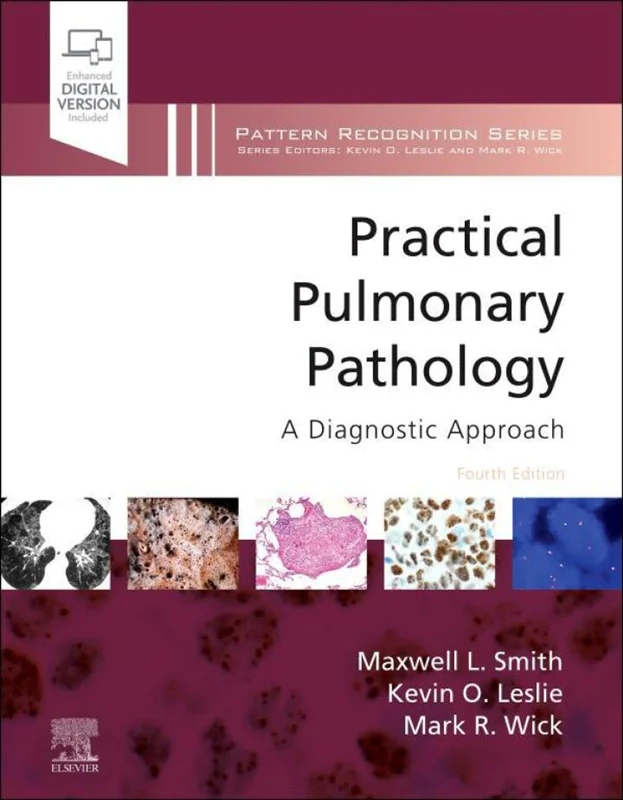 خرید و دانلود نسخه کامل کتاب
Practical Pulmonary Pathology: A Diagnostic Approach 4th Edition_6a5d2a6034d76.webp خرید و دانلود نسخه کامل کتاب
Practical Pulmonary Pathology: A Diagnostic Approach 4th Edition سورنا بوک - تصویر 1