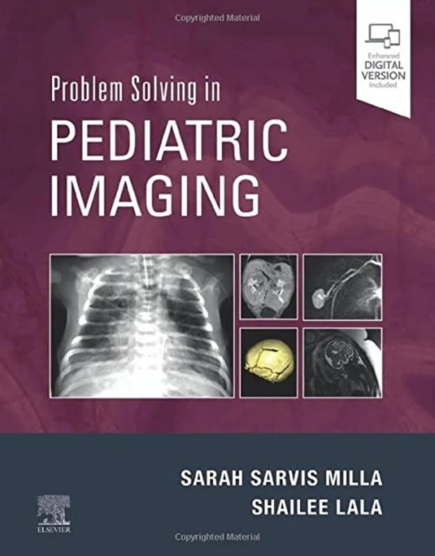 خرید و دانلود نسخه کامل کتاب
Problem Solving in Pediatric Imaging_6a5eff476b66d.webp خرید و دانلود نسخه کامل کتاب
Problem Solving in Pediatric Imaging - تصویر 1