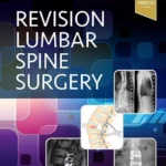 خرید و دانلود نسخه کامل کتاب 
Revision Lumbar Spine Surgery