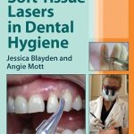 خرید و دانلود نسخه کامل کتاب Soft-Tissue Lasers in Dental Hygiene