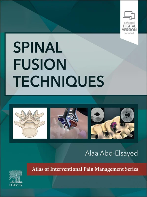 خرید و دانلود نسخه کامل کتاب
Spinal Fusion Techniques_6a5d3e45d7c21.webp خرید و دانلود نسخه کامل کتاب
Spinal Fusion Techniques سورنا بوک - تصویر 1