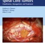 خرید و دانلود نسخه کامل کتاب 
Spine and Spinal Cord Tumors: Classification, Management, and Treatment