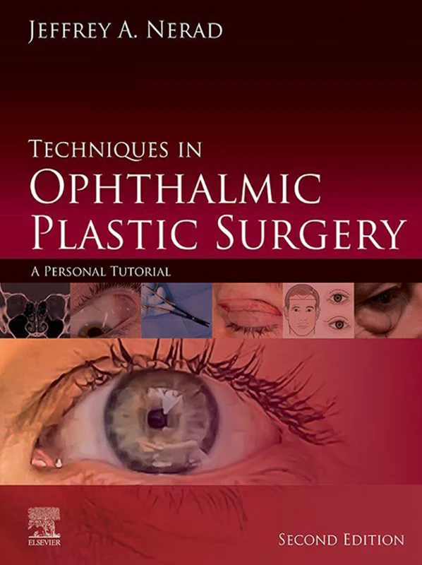 خرید و دانلود نسخه کامل کتاب
Techniques in Ophthalmic Plastic Surgery: A Personal Tutorial 2nd Edition_6a5f65e1330e0.webp خرید و دانلود نسخه کامل کتاب
Techniques in Ophthalmic Plastic Surgery: A Personal Tutorial 2nd Edition - تصویر 1