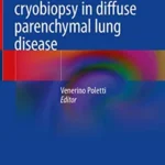خرید و دانلود نسخه کامل کتاب 
Transbronchial cryobiopsy in diffuse parenchymal lung disease