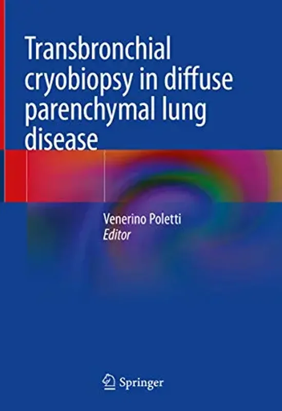 خرید و دانلود نسخه کامل کتاب
Transbronchial cryobiopsy in diffuse parenchymal lung disease_6a5fb859ccad4.webp خرید و دانلود نسخه کامل کتاب
Transbronchial cryobiopsy in diffuse parenchymal lung disease - تصویر 1