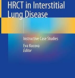 خرید و دانلود نسخه کامل کتاب HRCT in Interstitial Lung Disease: Instructive Case Studies