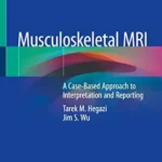 خرید و دانلود نسخه کامل کتاب Musculoskeletal MRI: A Case-Based Approach to Interpretation and Reporting