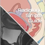 خرید و دانلود نسخه کامل کتاب Radiology Simple Guide: Female Pelvis MRI: Step by Step Guide by I & A