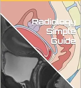 خرید و دانلود نسخه کامل کتاب Radiology Simple Guide: Female Pelvis MRI: Step by Step Guide by I & A