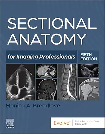 خرید و دانلود نسخه کامل کتاب Sectional Anatomy for Imaging Professionals – E-Book_6a6e02e0710f0.webp خرید و دانلود نسخه کامل کتاب Sectional Anatomy for Imaging Professionals – E-Book