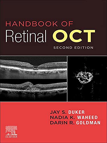خرید و دانلود نسخه کامل کتاب Handbook of Retinal OCT: Optical Coherence Tomography E-Book 2nd Edition_6a6e359be1e9b.jpeg خرید و دانلود نسخه کامل کتاب Handbook of Retinal OCT: Optical Coherence Tomography E-Book 2nd Edition
