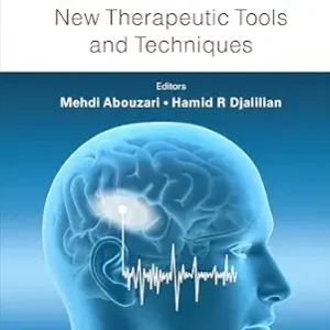 خرید و دانلود نسخه کامل کتاب Tinnitus