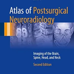 خرید و دانلود نسخه کامل کتاب Atlas of Postsurgical Neuroradiology: Imaging of the Brain, Spine, Head, and Neck