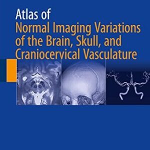 خرید و دانلود نسخه کامل کتاب Atlas of Normal Imaging Variations of the Brain, Skull, and Craniocervical Vasculature