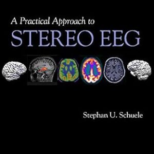 خرید و دانلود نسخه کامل کتاب A Practical Approach to Stereo EEG