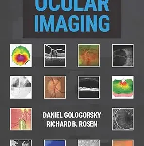 خرید و دانلود نسخه کامل کتاب Principles of Ocular Imaging