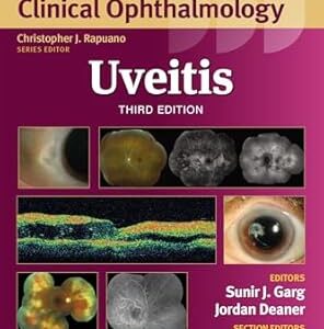 خرید و دانلود نسخه کامل کتاب Uveitis (Wills Eye Institute Atlas Series)