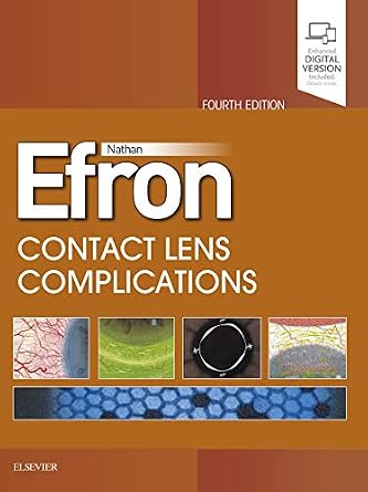 خرید و دانلود نسخه کامل کتاب Contact Lens Complications E-Book_6a6f2c6ebbb6f.jpeg خرید و دانلود نسخه کامل کتاب Contact Lens Complications E-Book
