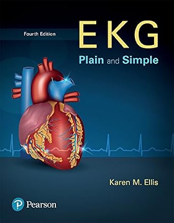 خرید و دانلود نسخه کامل کتاب EKG Plain and Simple_6a6e4c094e262.jpeg خرید و دانلود نسخه کامل کتاب EKG Plain and Simple