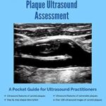 خرید و دانلود نسخه کامل کتاب Carotid Atherosclerotic Plaque Ultrasound Assessment: A Pocket Guide for Ultrasound Practitioners