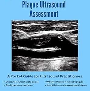 خرید و دانلود نسخه کامل کتاب Carotid Atherosclerotic Plaque Ultrasound Assessment: A Pocket Guide for Ultrasound Practitioners