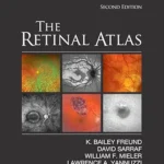 خرید و دانلود نسخه کامل کتاب The Retinal Atlas E-Book
