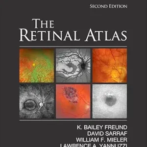 خرید و دانلود نسخه کامل کتاب The Retinal Atlas E-Book