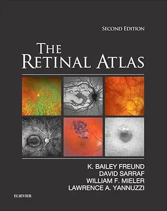خرید و دانلود نسخه کامل کتاب The Retinal Atlas E-Book_6a6dff0f70f14.webp خرید و دانلود نسخه کامل کتاب The Retinal Atlas E-Book