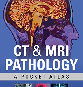 خرید و دانلود نسخه کامل کتاب CT & MRI Pathology: A Pocket Atlas, Third Edition 3rd Edition