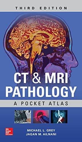 خرید و دانلود نسخه کامل کتاب CT & MRI Pathology: A Pocket Atlas, Third Edition 3rd Edition_6a6e4d48e2300.jpeg خرید و دانلود نسخه کامل کتاب CT & MRI Pathology: A Pocket Atlas, Third Edition 3rd Edition