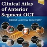 خرید و دانلود نسخه کامل کتاب Clinical Atlas of Anterior Segment OCT: Ocular Coherence Tomography – E-Book