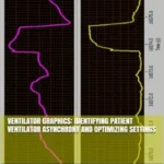 خرید و دانلود نسخه کامل کتاب Ventilator Graphics: Identifying Patient Ventilator Asynchrony and Optimizing Settings