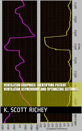 خرید و دانلود نسخه کامل کتاب Ventilator Graphics: Identifying Patient Ventilator Asynchrony and Optimizing Settings_6a6fbb886e7c7.webp خرید و دانلود نسخه کامل کتاب Ventilator Graphics: Identifying Patient Ventilator Asynchrony and Optimizing Settings