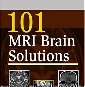 خرید و دانلود نسخه کامل کتاب 101 MRI Brain Solutions