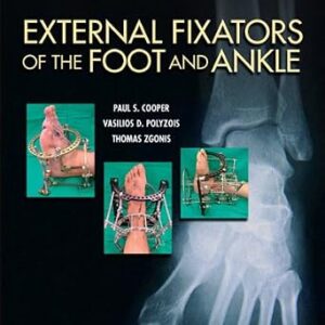 خرید و دانلود نسخه کامل کتاب External Fixators of the Foot and Ankle