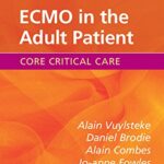 خرید و دانلود نسخه کامل کتاب ECMO in the Adult Patient (Core Critical Care) 1st Edition