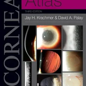 خرید و دانلود نسخه کامل کتاب Cornea Atlas E-Book (Expert Consult)