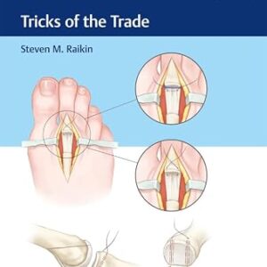 خرید و دانلود نسخه کامل کتاب Foot and Ankle Surgery: Tricks of the Trade